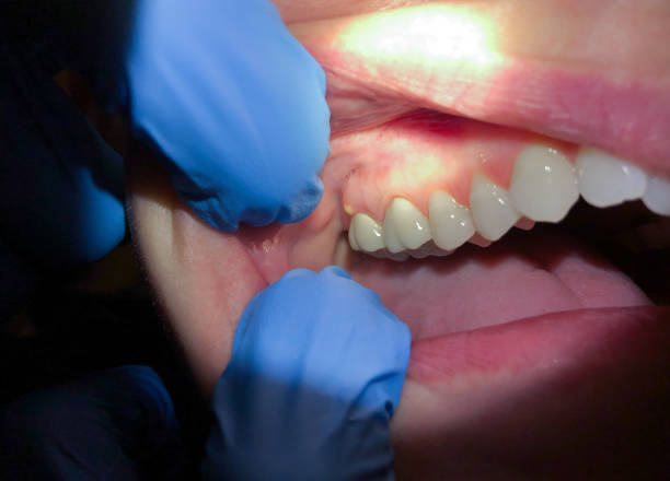 Best Lost Filling or Crown Replacement in West Monroe, MI